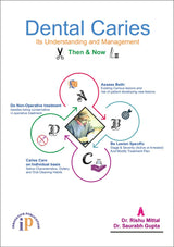 Dental Caries (Its Understanding and Management) Then & Now - Retail Maharaj