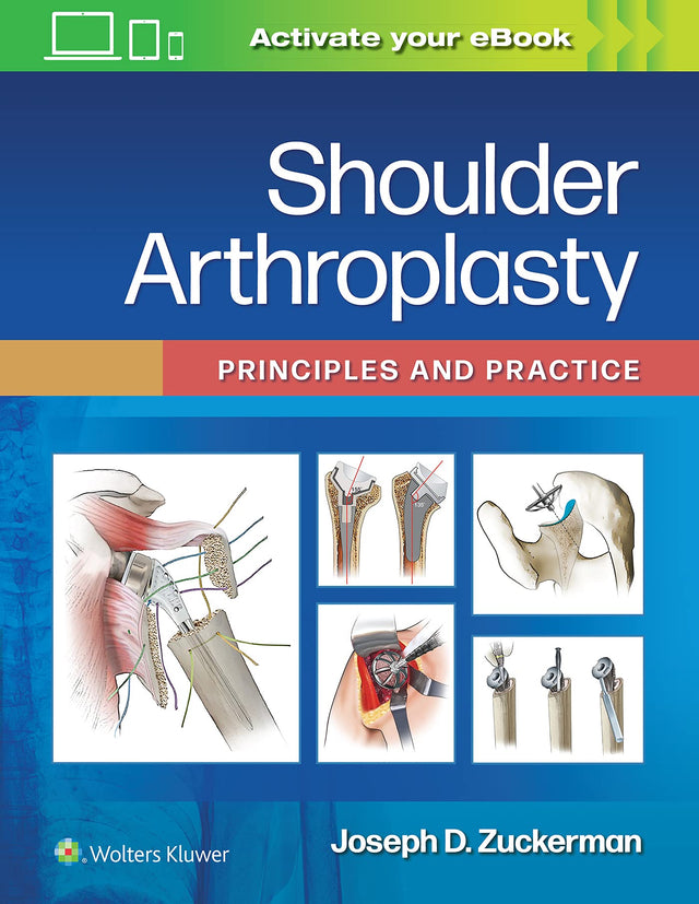 Shoulder Arthroplasty: Principles and Practice - Retail Maharaj