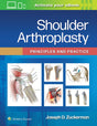 Shoulder Arthroplasty: Principles and Practice - Retail Maharaj