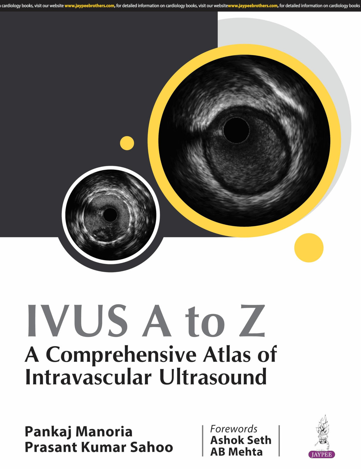 IVUS A TO Z : A COMPREHENSIVE ATLAS OF INTRAVASCULAR ULTRASOUND - Retail Maharaj