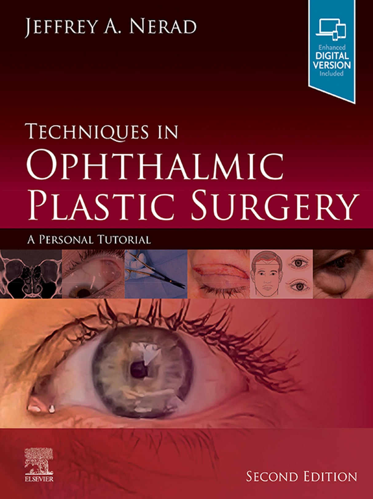 Techniques in Ophthalmic Plastic Surgery E-Book: A Personal Tutorial - Retail Maharaj