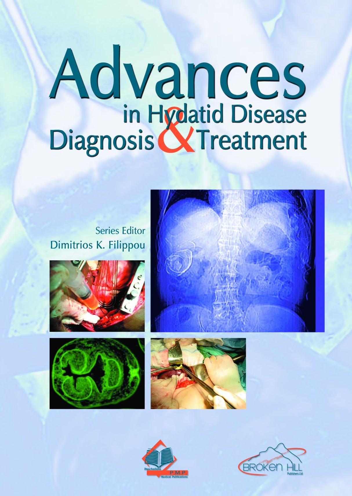 ADVANCES IN HYDATID DISEASE DIAGNOSIS & TREATMENT - Retail Maharaj