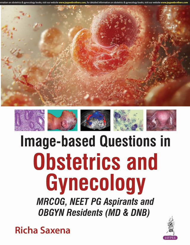 Image-based Questions in Obstetrics and Gynecology: An Evidence Based Color Atlas - Retail Maharaj