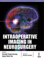INTRAOPERATIVE IMAGING IN NEUROSURGERY - Retail Maharaj