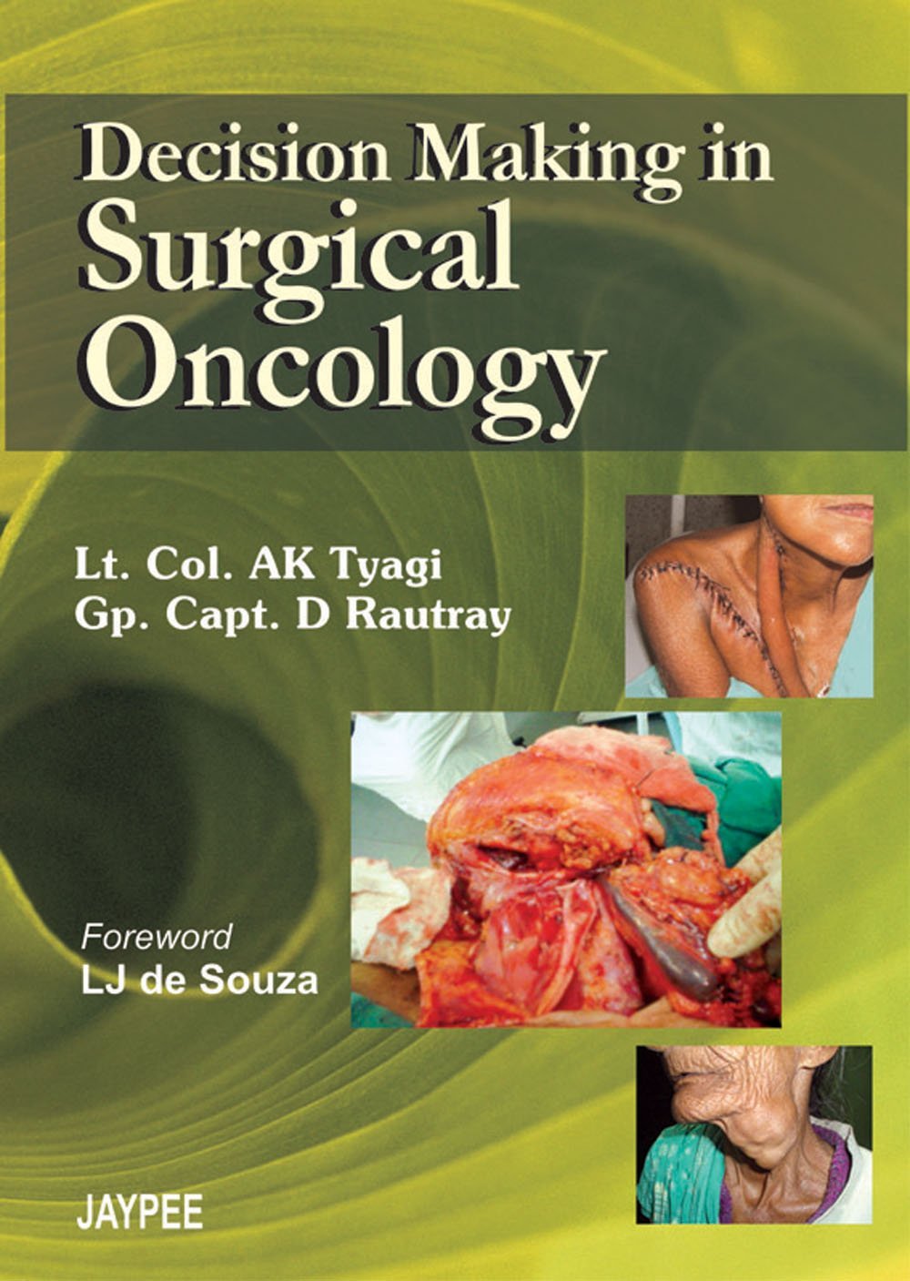 DECISION MAKING IN SURGICAL ONCOLOGY - Retail Maharaj