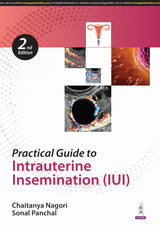 PRACTICAL GUIDE TO INTRAUTERINE INSEMINATION (IUI) - Retail Maharaj