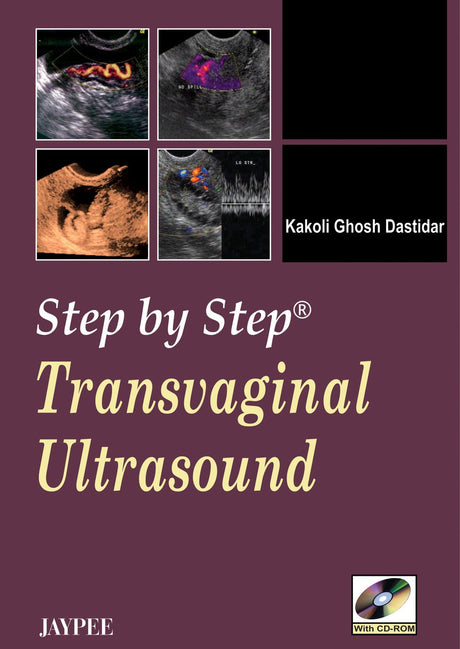 Step by Step Transvaginal Ultrasound with CD-ROM - Retail Maharaj