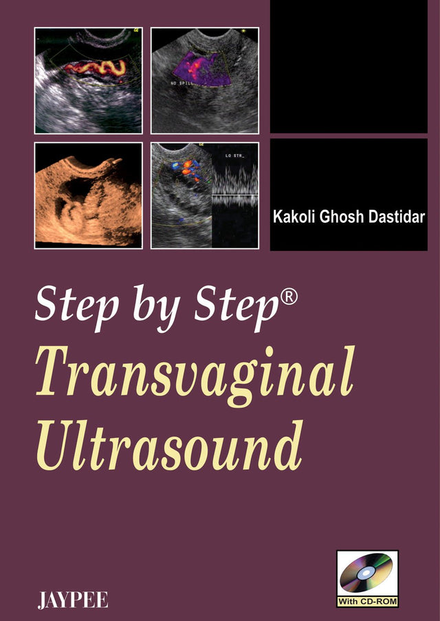 Step by Step Transvaginal Ultrasound with CD-ROM - Retail Maharaj