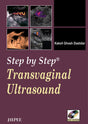 Step by Step Transvaginal Ultrasound with CD-ROM - Retail Maharaj