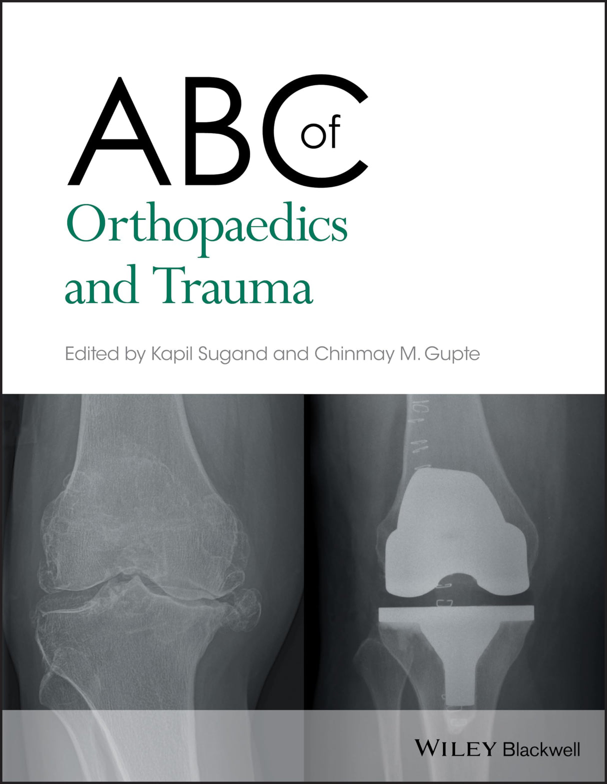 ABC of Orthopaedics and Trauma: 257 (ABC Series) - Retail Maharaj