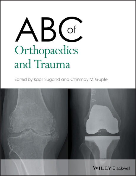 ABC of Orthopaedics and Trauma: 257 (ABC Series) - Retail Maharaj