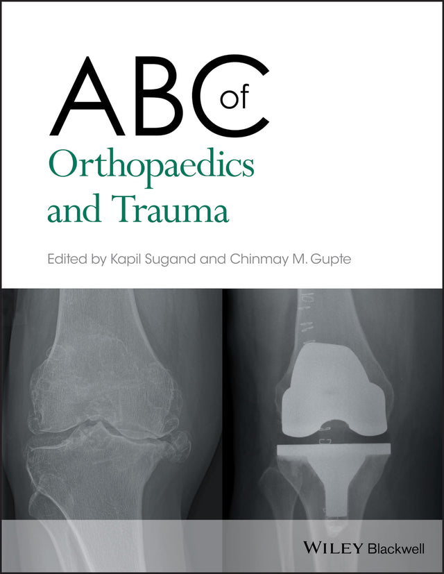 ABC of Orthopaedics and Trauma: 257 (ABC Series) - Retail Maharaj
