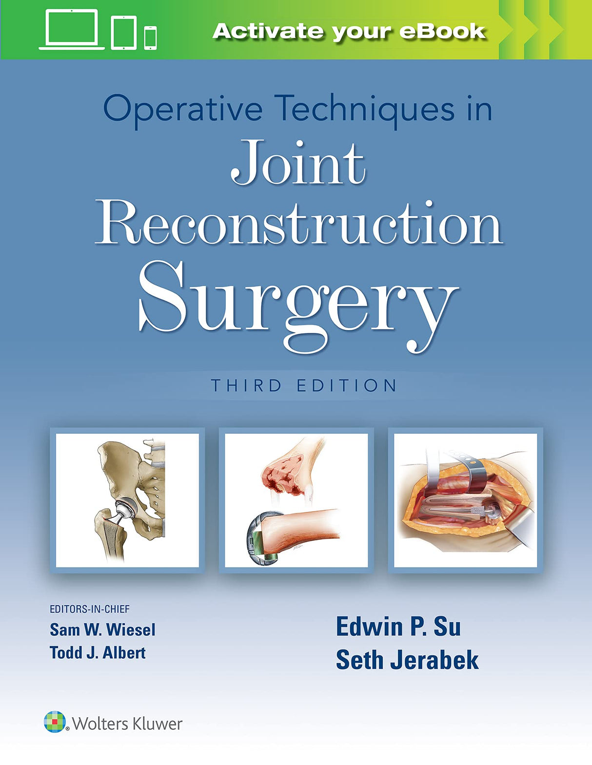 Operative Techniques in Joint Reconstruction Surgery - Retail Maharaj