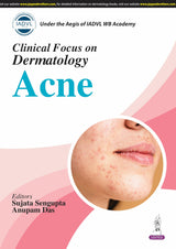 CLINICAL FOCUS ON DERMATOLOGY ACNE - Retail Maharaj