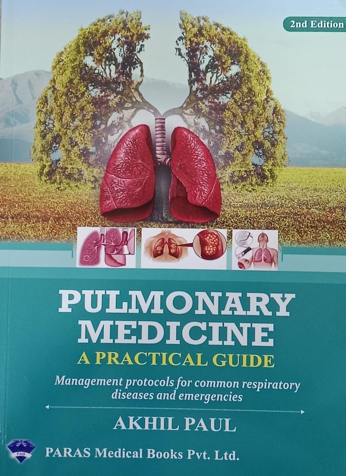 Pulmonary Medicine A practical Guide Management Protocols for common respiratory disease and emergencies [Paperback] Akhil Paul [Paperback] Akhil Paul - Retail Maharaj