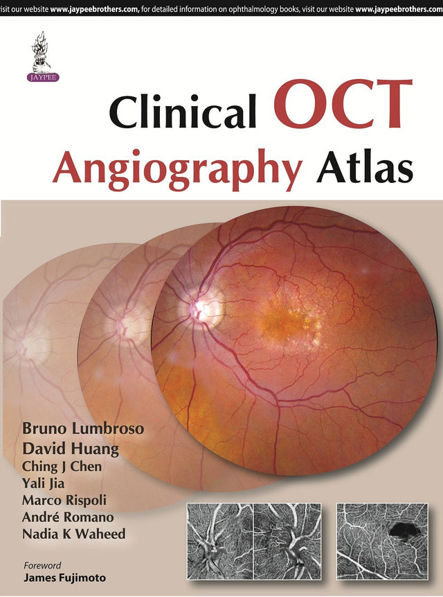 Clinical Oct Angiography Atlas - Retail Maharaj
