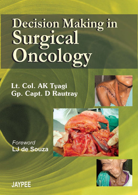DECISION MAKING IN SURGICAL ONCOLOGY - Retail Maharaj