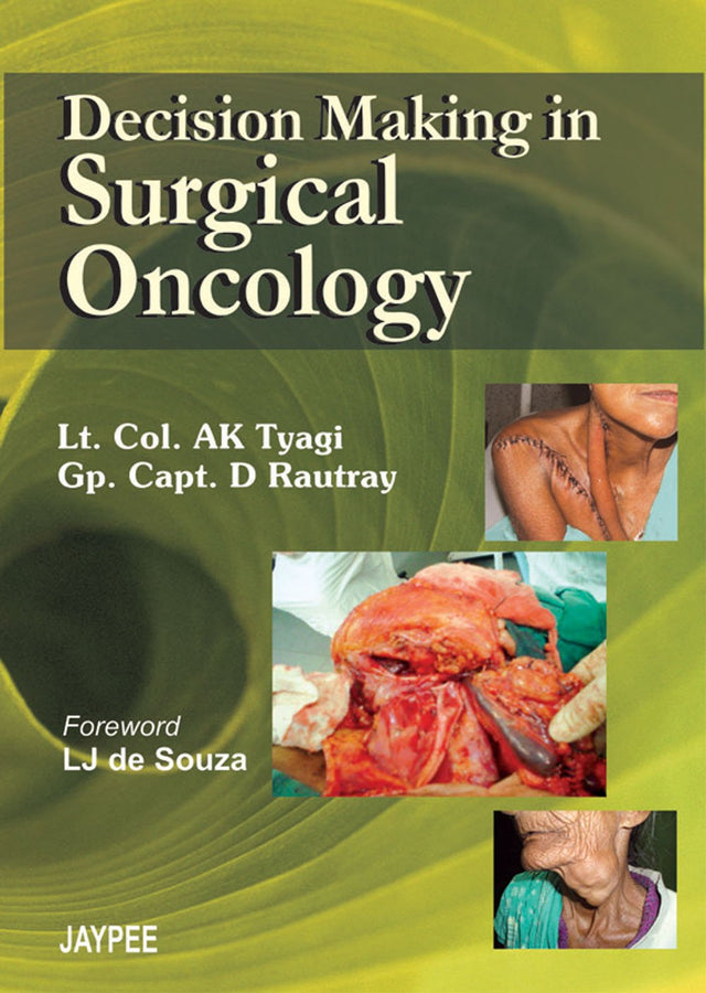DECISION MAKING IN SURGICAL ONCOLOGY - Retail Maharaj