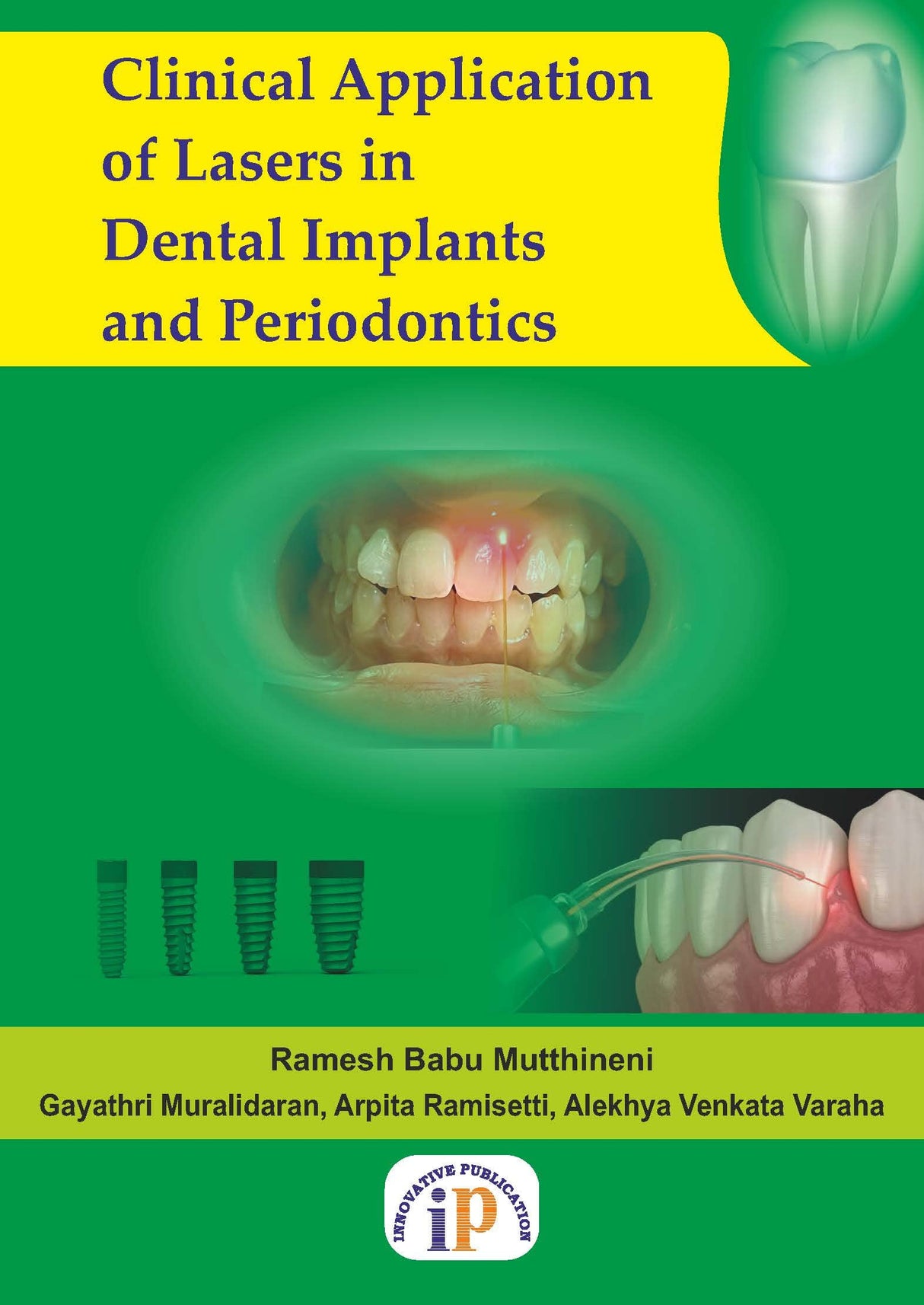 Clinical Application of Lasers in Dental Implants and Periodontics - Retail Maharaj