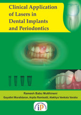 Clinical Application of Lasers in Dental Implants and Periodontics - Retail Maharaj