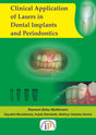 Clinical Application of Lasers in Dental Implants and Periodontics - Retail Maharaj