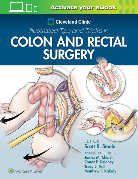 Cleveland Clinic Illustrated Tips and Tricks in Colon and Rectal Surgery - Retail Maharaj