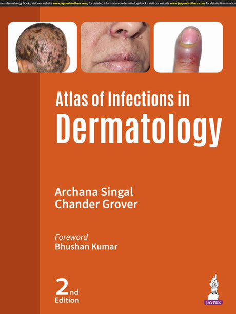 ATLAS OF INFECTIONS IN DERMATOLOGY - Retail Maharaj