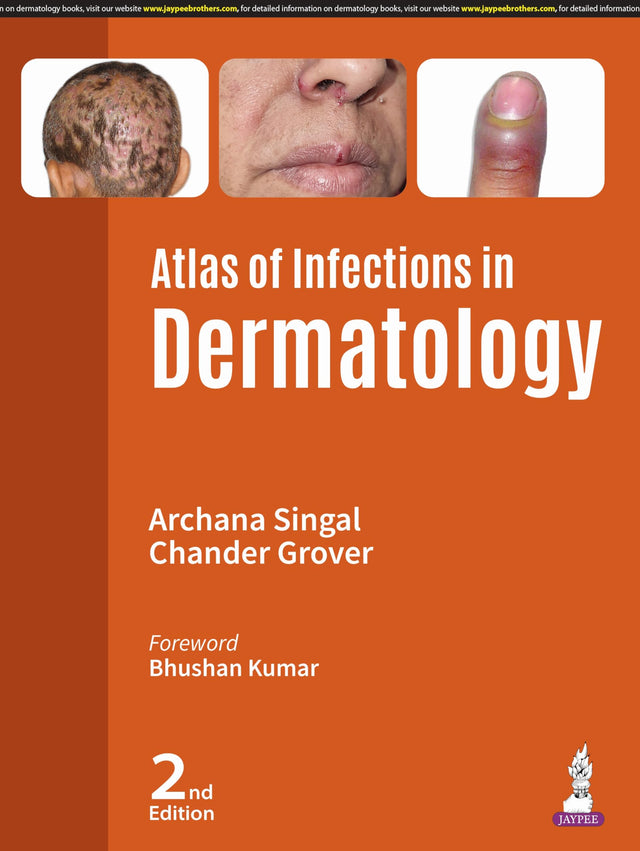 ATLAS OF INFECTIONS IN DERMATOLOGY - Retail Maharaj
