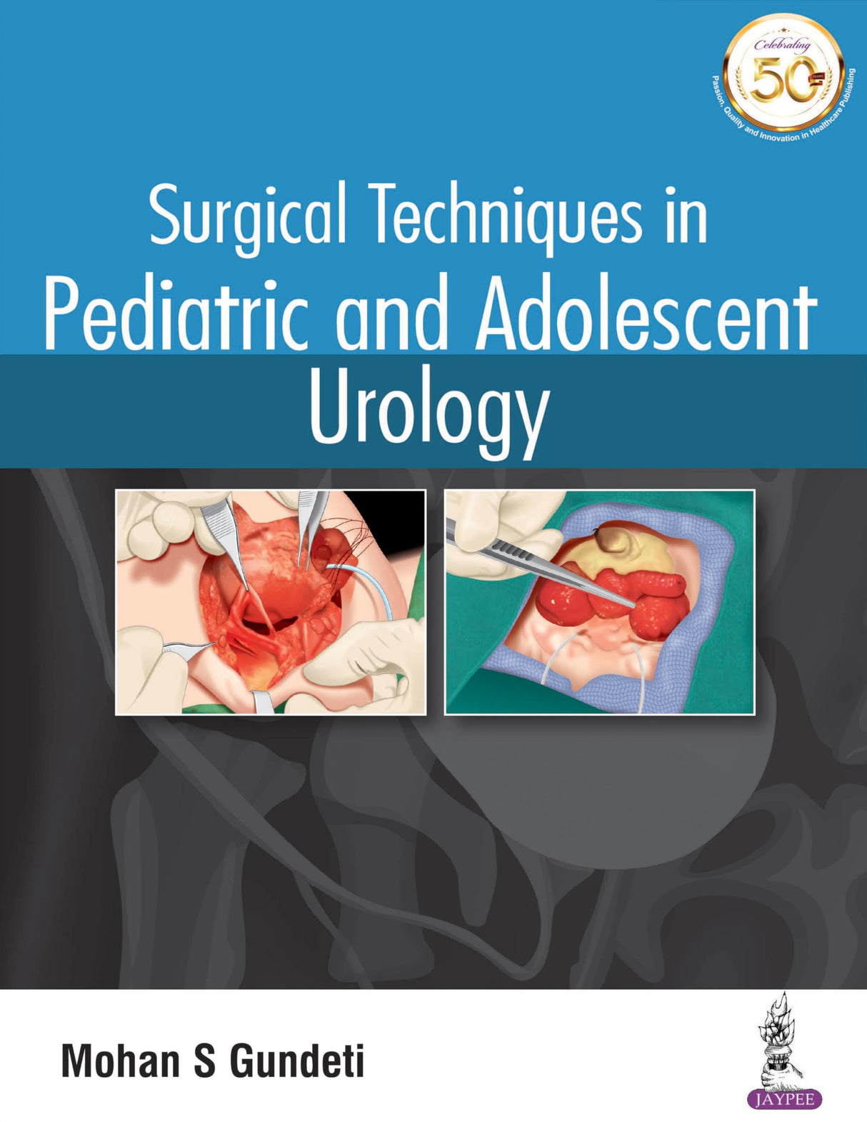 Surgical Techniques in Pediatric and Adolescent Urology - Retail Maharaj