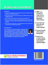 Retina Cases Illustrated - Retail Maharaj