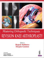 Mastering Orthopedic Techniques Revision Knee Arthroplasty - Retail Maharaj