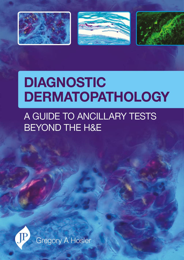 DIAGNOSTIC DERMATOPATHOLOGY:A GUIDE TO ANCILLARY TESTS BEYOND THE H&E - Retail Maharaj