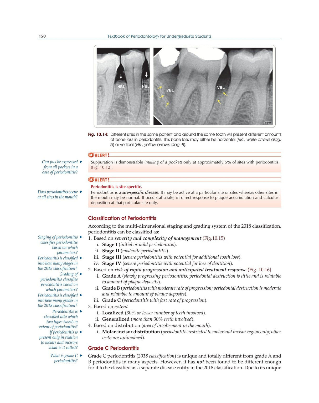 Textbook of Periodontology for Undergraduate Students - 2024 - Retail Maharaj