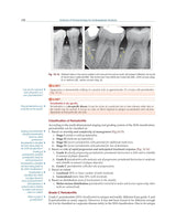 Textbook of Periodontology for Undergraduate Students - 2024 - Retail Maharaj