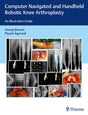 Computer Navigated and Handheld Robotic Knee Arthroplasty: An Illustrative Guide - Retail Maharaj