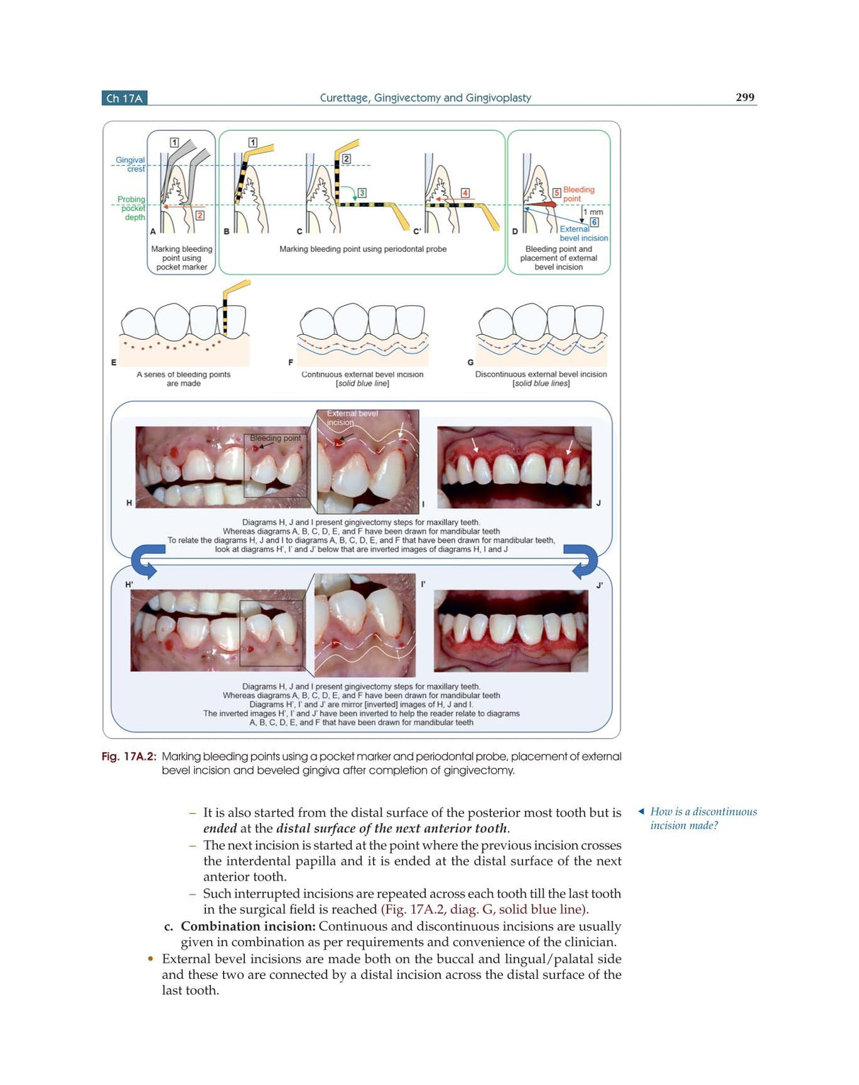 Textbook of Periodontology for Undergraduate Students - 2024 - Retail Maharaj