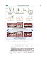 Textbook of Periodontology for Undergraduate Students - 2024 - Retail Maharaj