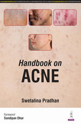 HANDBOOK ON ACNE - Retail Maharaj