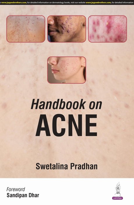 HANDBOOK ON ACNE - Retail Maharaj