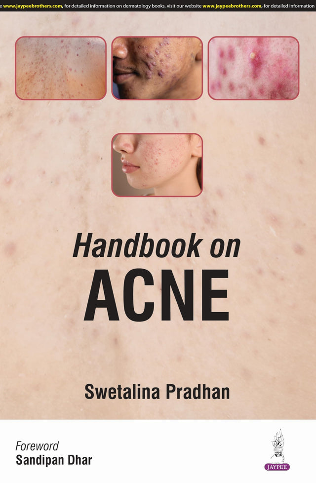 HANDBOOK ON ACNE - Retail Maharaj