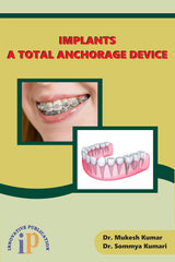 Implants - A Total Anchorage Device - Retail Maharaj