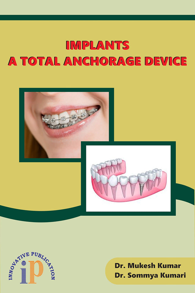 Implants - A Total Anchorage Device - Retail Maharaj