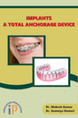 Implants - A Total Anchorage Device - Retail Maharaj