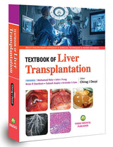 Liver Transplantation - Retail Maharaj