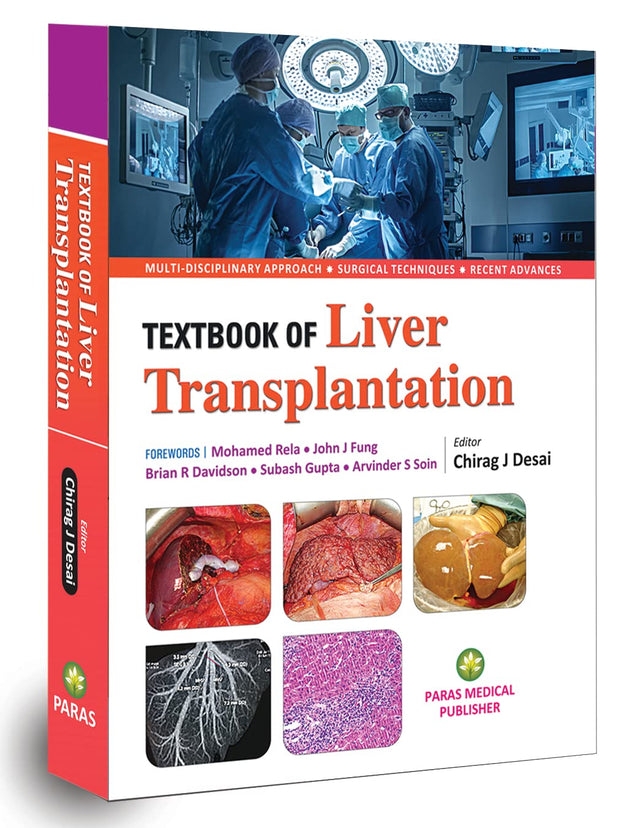 Liver Transplantation - Retail Maharaj