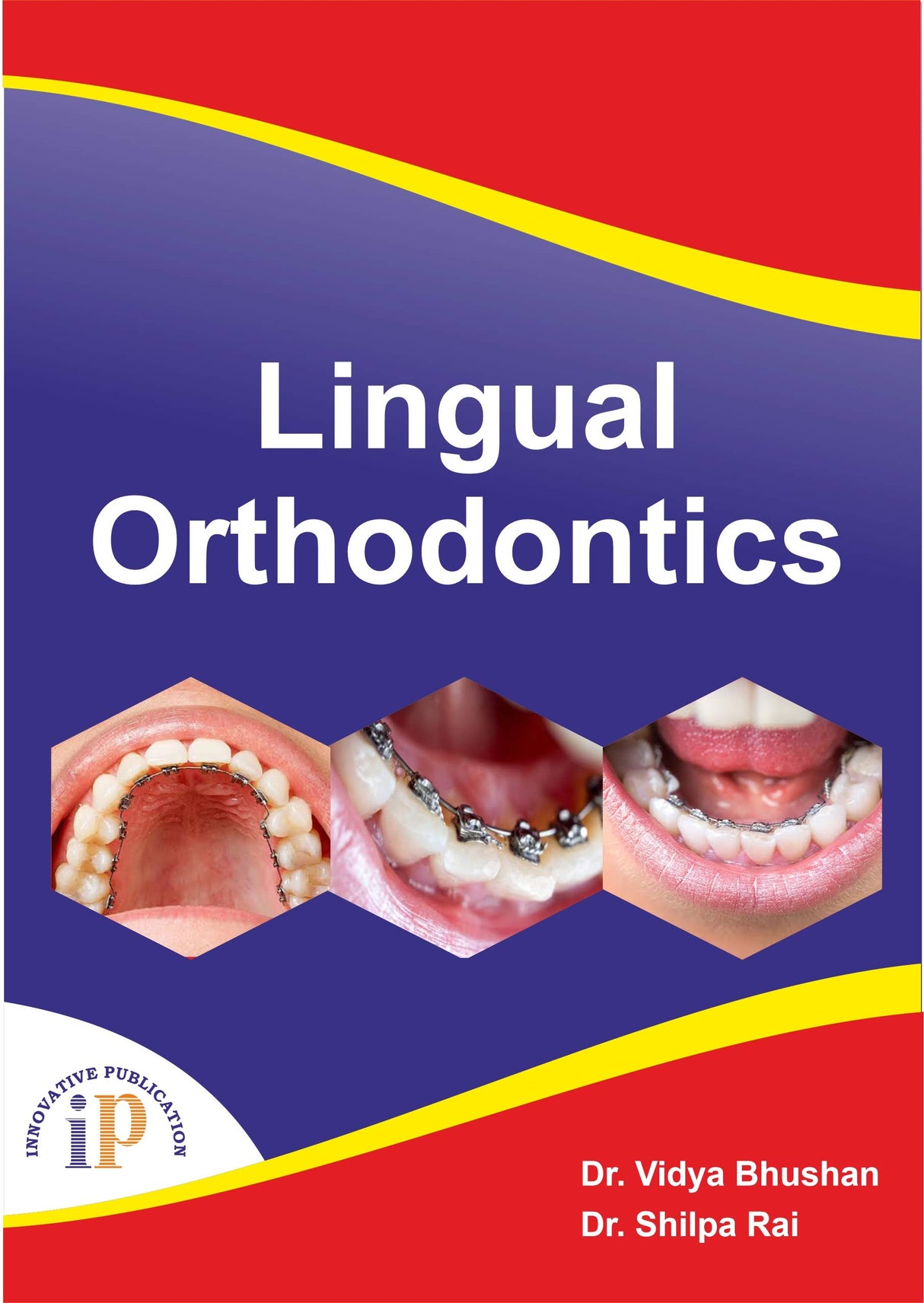 Lingual Orthodontics - Retail Maharaj