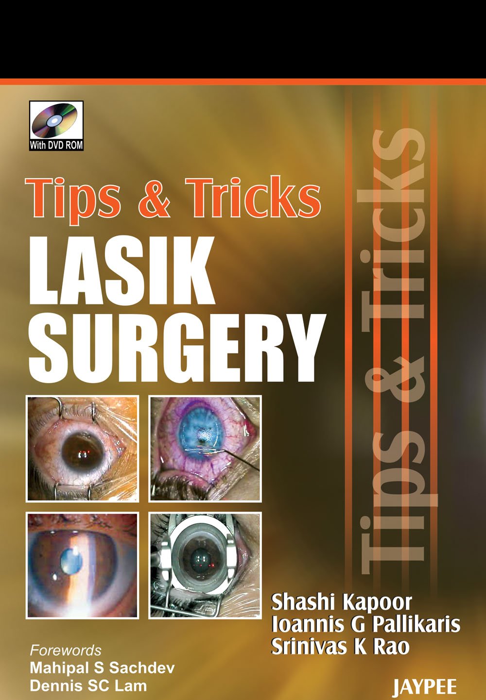 Tips & Tricks Lasik Surgery with DVD-ROM - Retail Maharaj