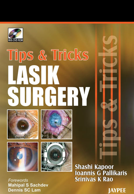 Tips & Tricks Lasik Surgery with DVD-ROM - Retail Maharaj