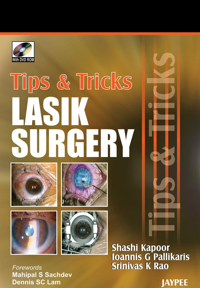 Tips & Tricks Lasik Surgery with DVD-ROM - Retail Maharaj