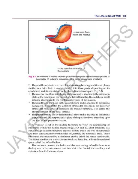 ANATOMICAL PRINCIPLES OF ENDOSCOPIC SINUS SURGERY: A STEP BY STEP APPROACH WITH INTERACTIVE CD-ROM - Retail Maharaj